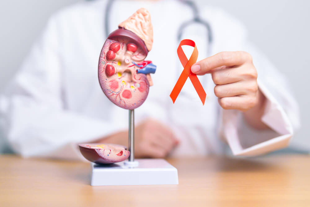Centre for Uro-Oncology